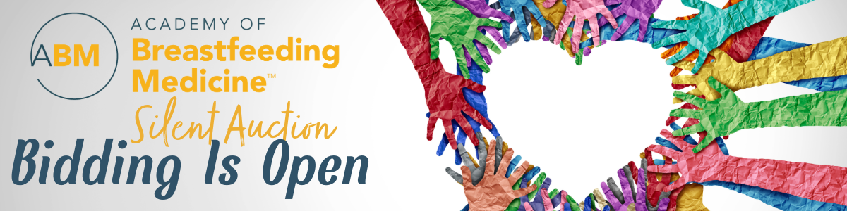 Silent auction banner - bidding is now open